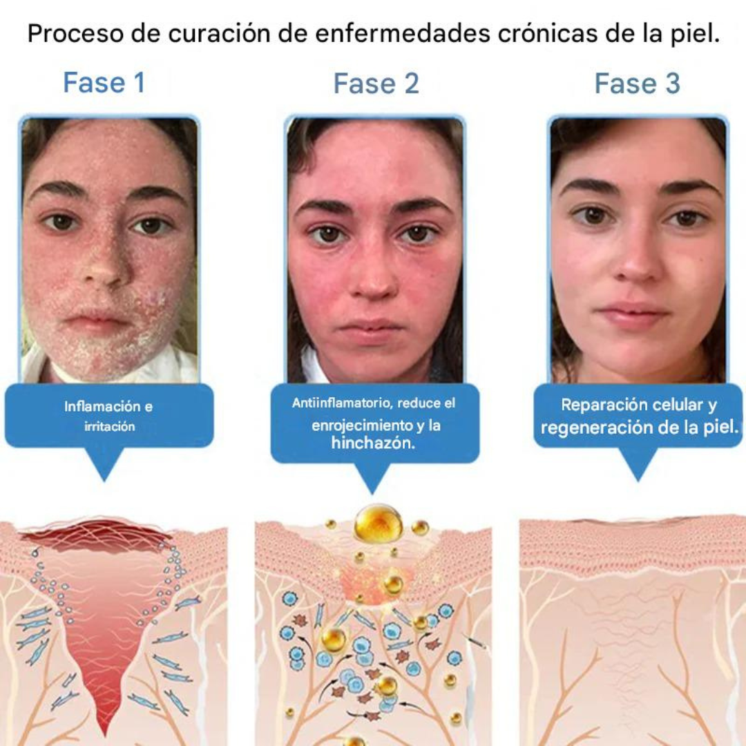 Crema antiinflamatoria multisíntomas con veneno de abeja (OFERTA 2X1)