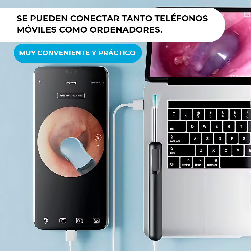 Kit Limpiador de Oídos con Cámara Inteligente para Smartphones