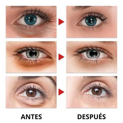 HappyEyes™️ - Serum Elimina Ojeras (OFERTA EXCLUSIVA)